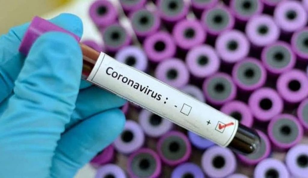 Autoridades descartan caso de coronavirus en Puente Alto