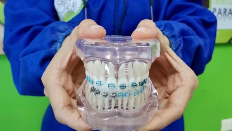 Descubre qué es la Ortodoncia y cómo funciona de la mano de DentiOral