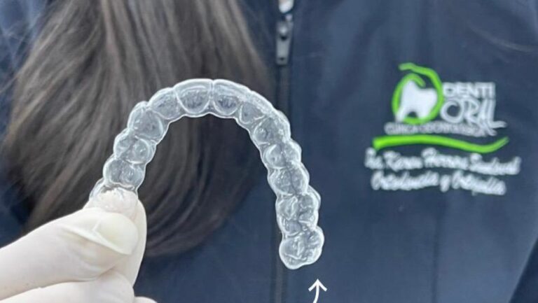 ¿Rechinas los dientes frecuentemente? Entonces sufres de bruxismo